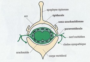 Figure 47 : Rappel anatomique et dénomination des différentes injections intrarachidiennes – Référence bibliographique n°14, page 69