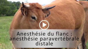 vignette para distale